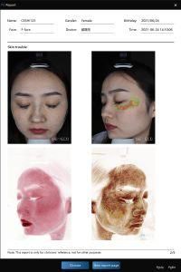Isemeco Skin Analyzer 3D Facial Skin Analysis for Professionals
