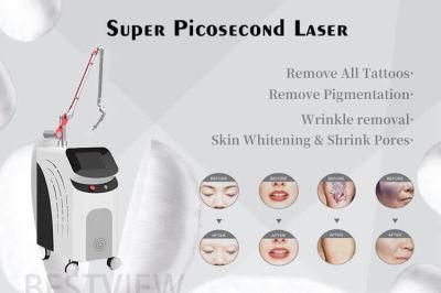 Professional Esthetician Equipment Super Picosecond Laser Tattoo Removal Machine